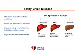 healthy lifestyles for healthy organs, Dr Chris Barry, Madurai Rotary Club, organ donation, transplantation, MOHAN Foundation, Dr Sunil Shroff, deceased donor transplant in India, bLifeNY, #drbarryindia